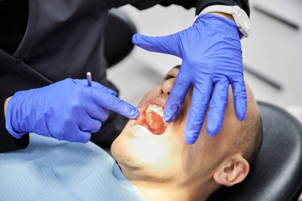 Best Emergency Dental Care for Broken or Chipped Teeth in Blountstown, FL